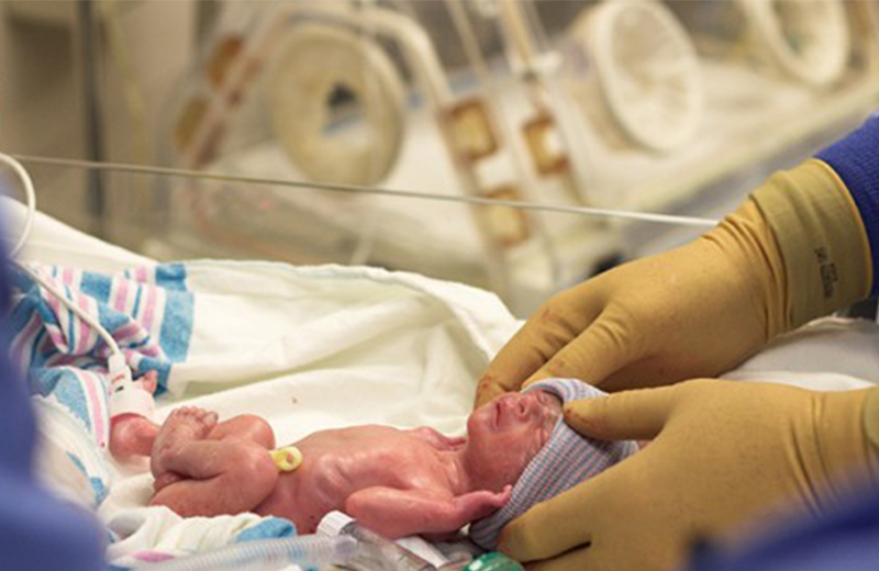 الولادة المبكرة والأسباب التي تؤدي إلى حدوثها
