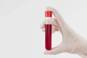تحليل الدم للحمل متى يبان بالتفاصيل وهل يمكن أن يخطئ؟