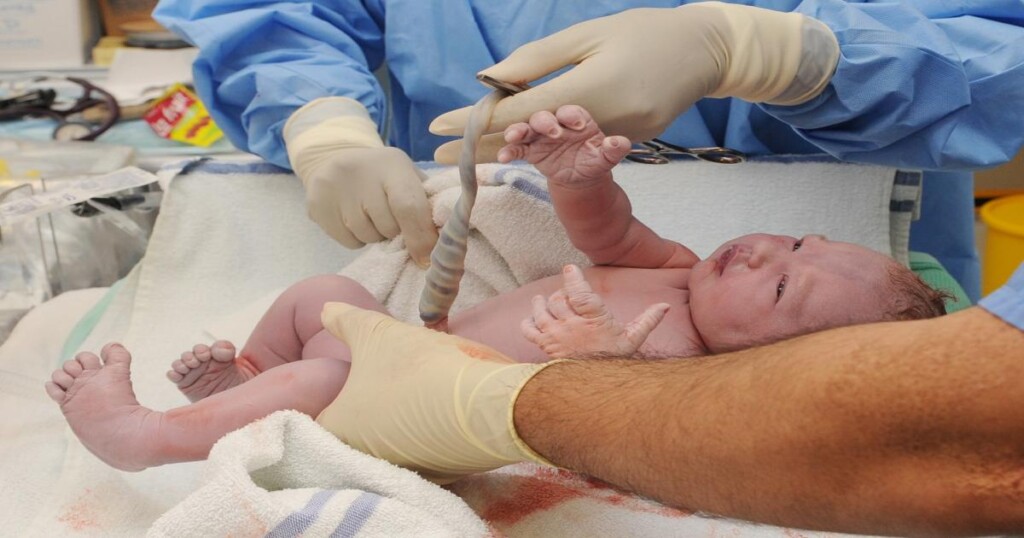 نصائح للوقاية من إنجاب اطفال مبتسرين وأسباب الولادة المبكرة